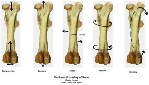 Restoration Of Bones Elastic Response Using Osteopathic Techniques