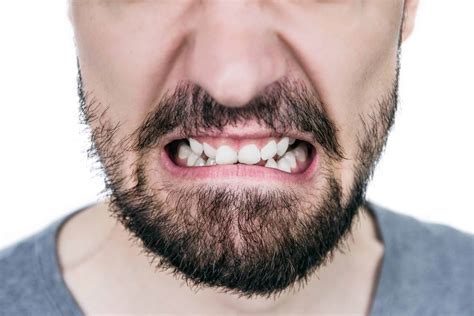 Impact Of Crooked Teeth To Oral Health Integrated Smiles Bendigo