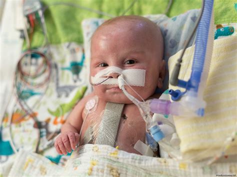 Baby Theo Inspires Hops For Hearts And Fight Against Congenital Heart Defects