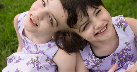 Ten Years In The Life Of Conjoined Twins Huffpost Uk