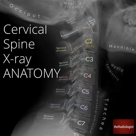 Cervical Spine X Ray Anatomy By Dr Naveen Sharma Grepmed The Best Porn Website