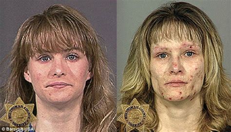 From Drugs To Mugs Shocking Before And After Photos Show Drug Addiction Takes Its Toll Daily