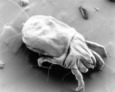 House Dust Mites Evolved A New Way To Protect Their Genome