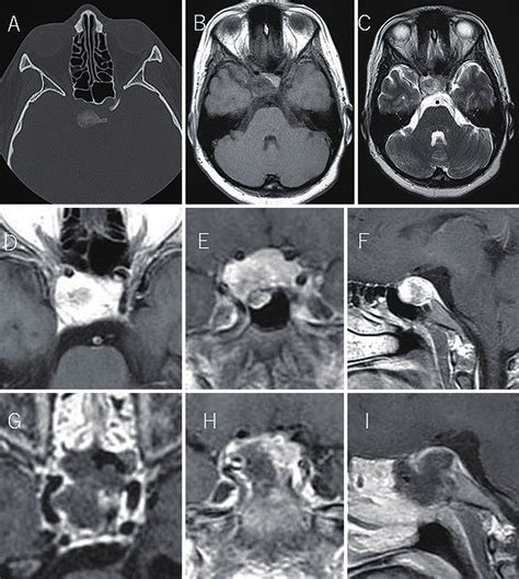 Perioperative Image Studies Preoperative Computed Tomography Of The