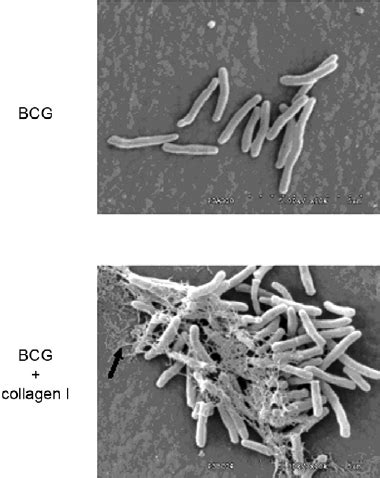 Effect Of Exogenous Collagen I On The Mycobacterium Bovis Bcg