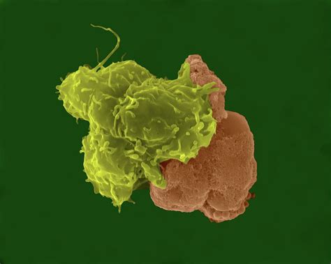 Blood Monocyte Photograph By Dennis Kunkel Microscopyscience Photo Library