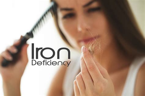 Top 124 Iron Deficiency Anaemia Hair Loss Polarrunningexpeditions
