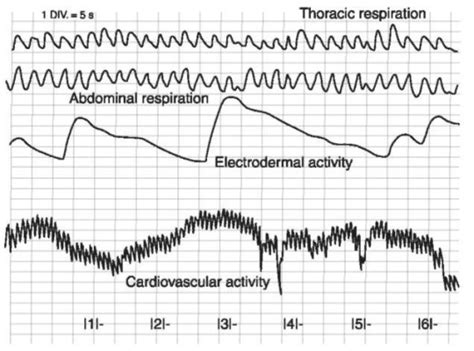 Electronic lie detection is a peculiarly american obsession. 5 facts you must know about Lie detector test ( polygraph ...