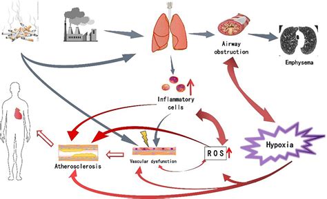 Frontiers Analysis Of Pathogenesis And Drug Treatment Of Chronic Obstructive Pulmonary Disease