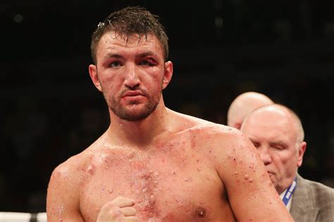 Hughie Furys Acne Steroids Or No Page 2 Boxing Forum