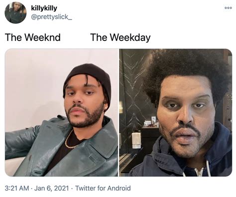 The Weekend Surgery The Weeknd Shows Off Freaky Face From Plastic