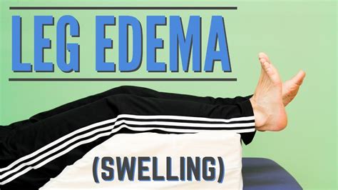 Top 7 Exercises For Leg Edema Or Swelling Program Or Protocol For