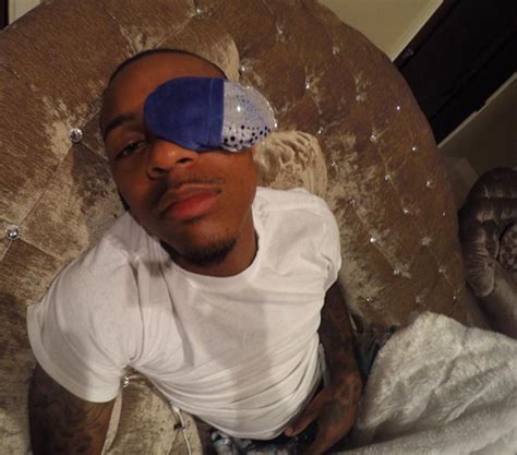 HoTgIsT Bow Wow Shows Off Eye Infection On Instagram