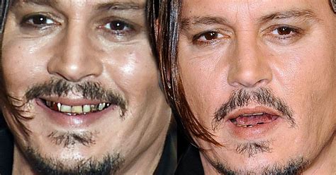 Johnny Depp Flashes His Gold And Stained Teeth After