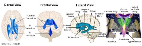 Neuroanatomy Online Lab 3 The Ventricles And Blood Supply The