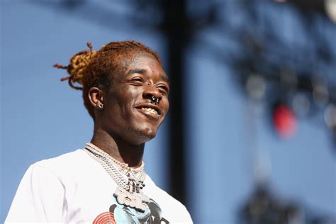 Lil Uzi Verts 24 Million Diamond Face Implant Can Fracture The Skull