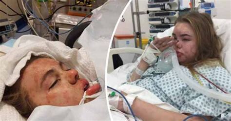 ‘this Is What Ecstasy Does Mum Posts Pics Of Teen In Coma After Taking