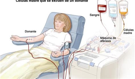 ¿quién Recibe Trasplantes De Células Madre Enfermeria Buenos Aires