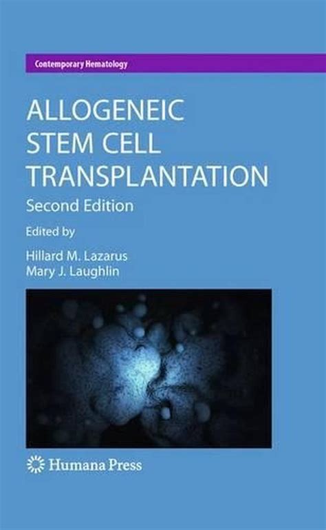 Allogeneic Stem Cell Transplantation Hardcover 9781934115336 Buy