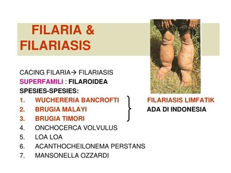 Ppt Filaria And Filariasis Powerpoint Presentation Id5076964