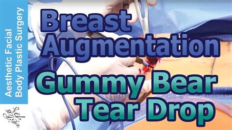 Shaped Anatomic Gummy Bear Tear Drop Cohesive Gel Breast Augmentation By Seattles Dr Parikh