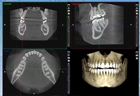 It was her first litter, she was much better at being a mom with her other. Write your dental cbct report by Ayoubelhajjami