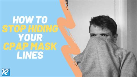 How To Remove Cpap Face Marks Guide Youtube
