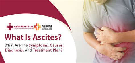 Ascites Symptoms Causes Diagnosis And Treatment Plans