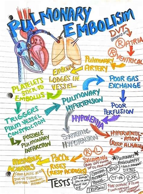 Pulmonary Embolism Nursing School Survival Nursing Notes Nursing