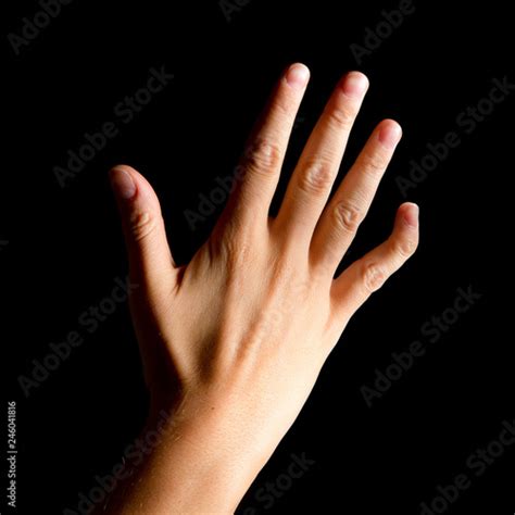 Woman Hand With The Pinky Little Finger Due To Arthritis Stock Photo