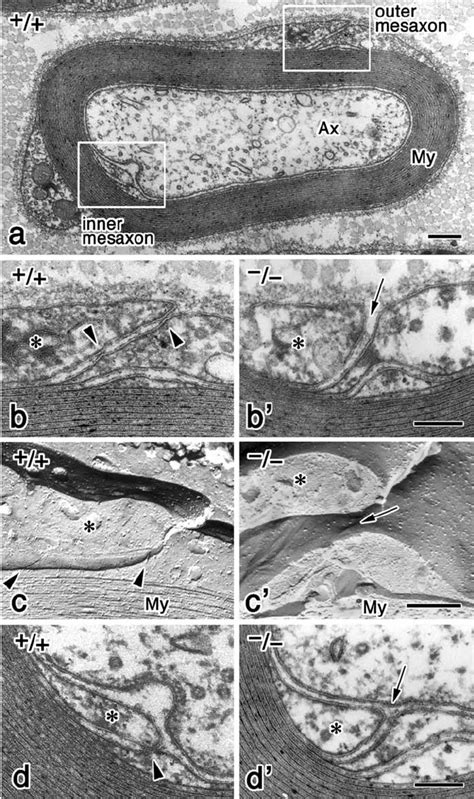 Absence Of Tjs In Peripheral Myelinated Axons Of Claudin 19deficient