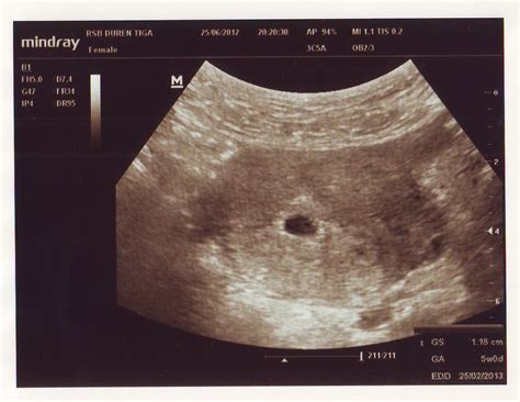 Hal ini bukanlah menstruasi melainkan adanya sperma yang menempel pada uterus (2). Just RaniaRi: Tanda-tanda Hamil Bukan yaa...(???)