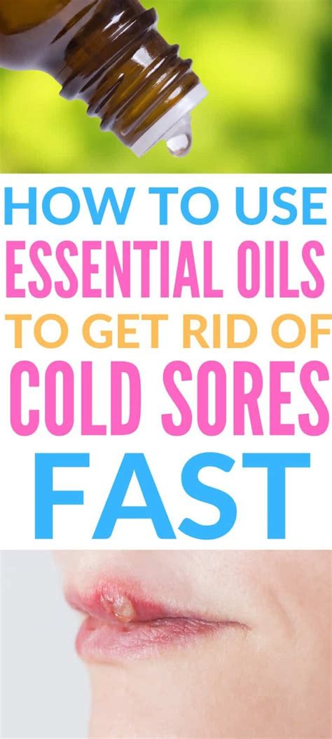 Essential Oils For Cold Sores Natural Cold Sore Remedy Essential
