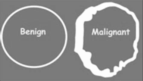 Differential Diagnosis Of Ring Enhancing Lesions In Contrast Enhanced