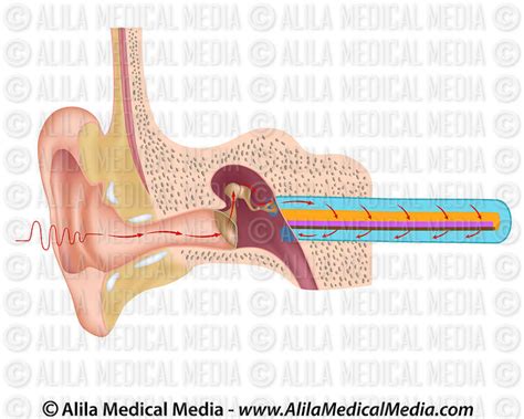 Alila Medical Media Anatomy Of The Cochlea Of Human Ear Medical