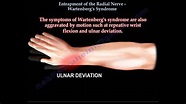Entrapment of Radial Nerve, Wartenberg's Syndrome - Everything You Need ...