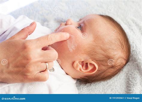 Baby With Atopic Dermatitis Getting Cream Put Care And Prevention Of