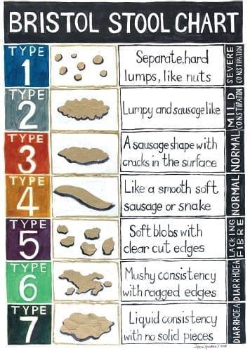 Zucchero Leggenda Schivare Bristol Stool Scale Poster St Descrivere Richiesta