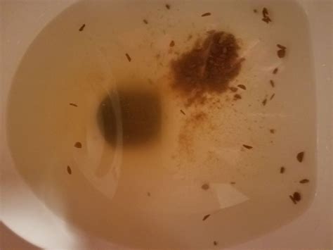 Parasites In Urine
