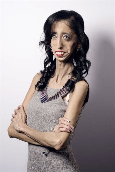 How Being Called The World S Ugliest Woman Transformed Her Life Lizzie Velásquez Women