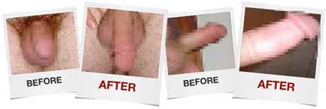 Penis Enlargement Before And After Study Results