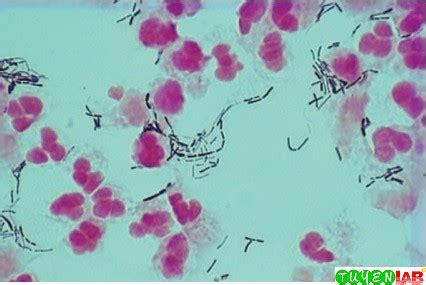 Bacteria which cannot or are difficult to gram stain. Microbiology Atlas of Direct examination in gram ...