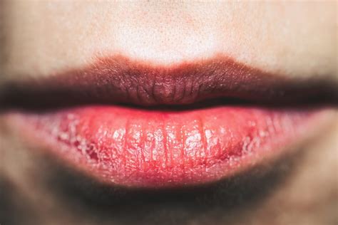 Secrets To Getting Rid Of Dry Skin On Lips Bellatory