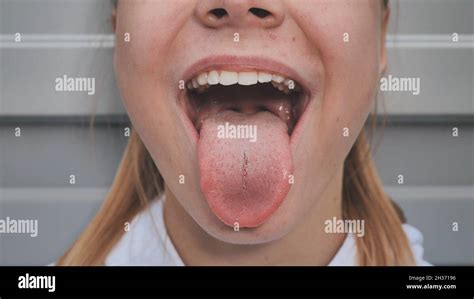 The Young Girl Opens Her Mouth And Shows Her Tongue Stamatology Theme