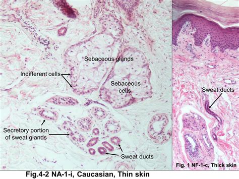 Block12fig 4 2 Sebaceous Glands And Sweat Glands
