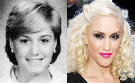 Look How Gwen Stefanis Plastic Surgery Has Helped Her Shift From
