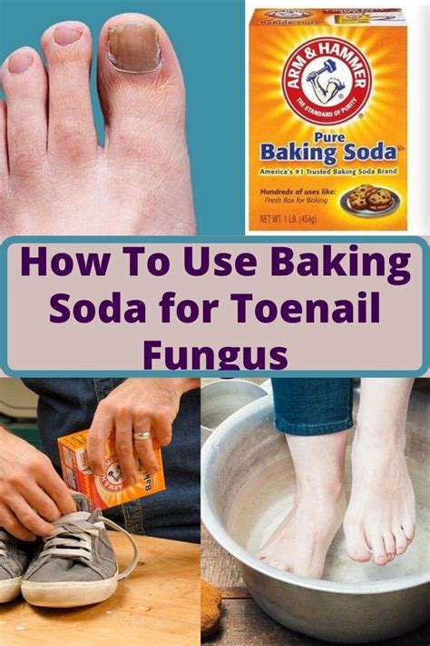 Baking Soda For Toenail Fungus Care Tips For Toenail Fungus Toenail
