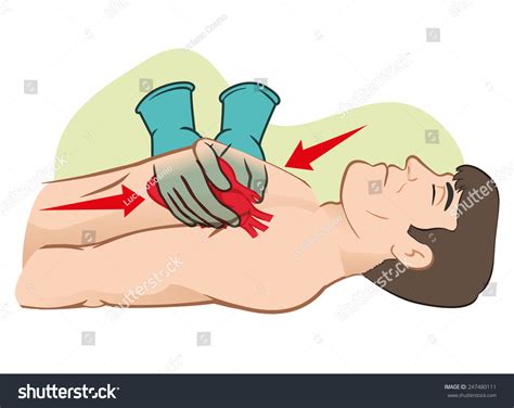 First Aid Cardiac Resuscitation Cpr Open Heart Massage For Resuscitation Ideal For Training