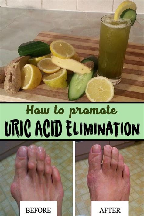 How To Promote Uric Acid Elimination Fitness Shortcut