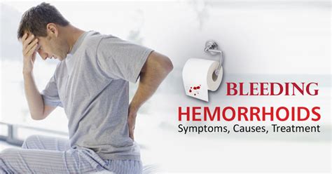 If You Are Suffering From Bleeding Hemorrhoids And You Want To Treat It